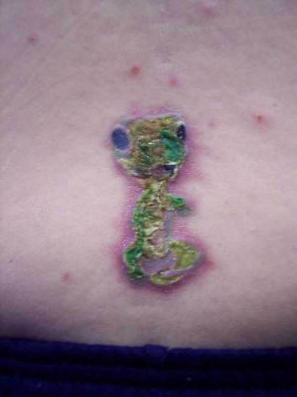 Infecciones de tatuajes y perforaciones (6)