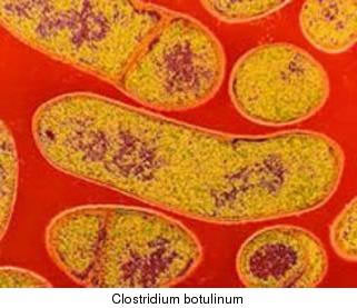 Clostridium botulinum Preguntas criminales 
