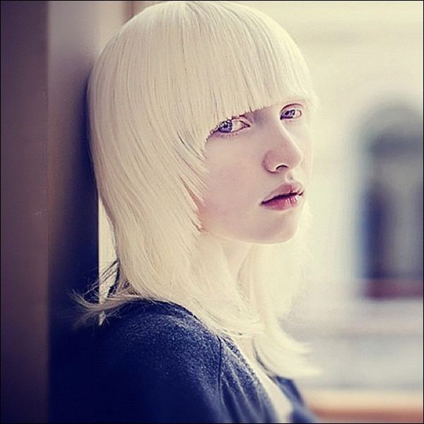 Nastya Zhidkova albina (3)