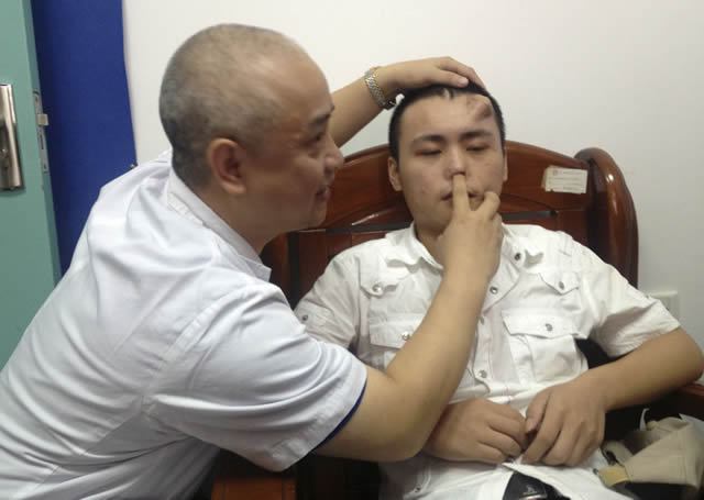 Científicos chinos cultivan nariz en frente de paciente (1)