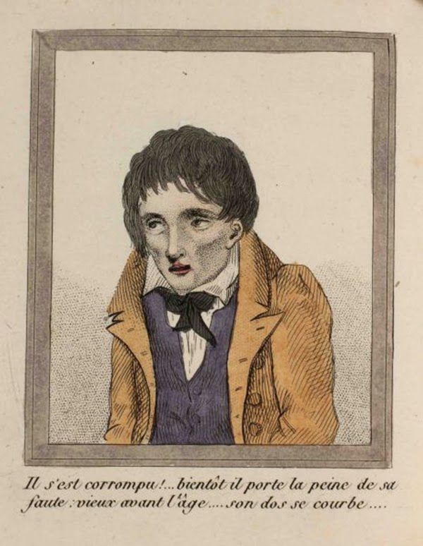 efectos del FAP ilustrados en un libro de 1830 (1)