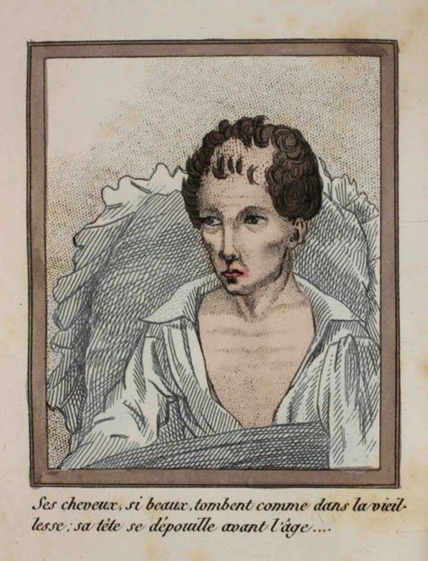 efectos del FAP ilustrados en un libro de 1830 (11)