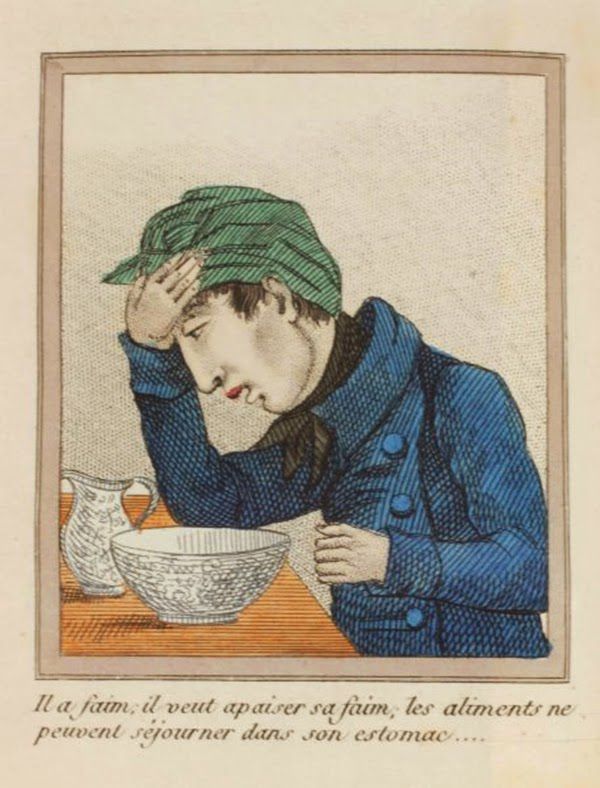 efectos del FAP ilustrados en un libro de 1830 (10)