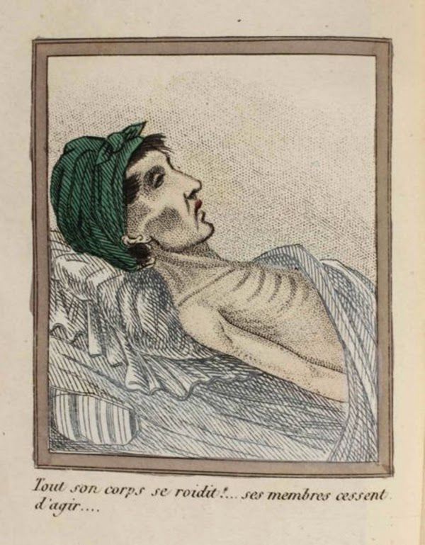 efectos del FAP ilustrados en un libro de 1830 (5)