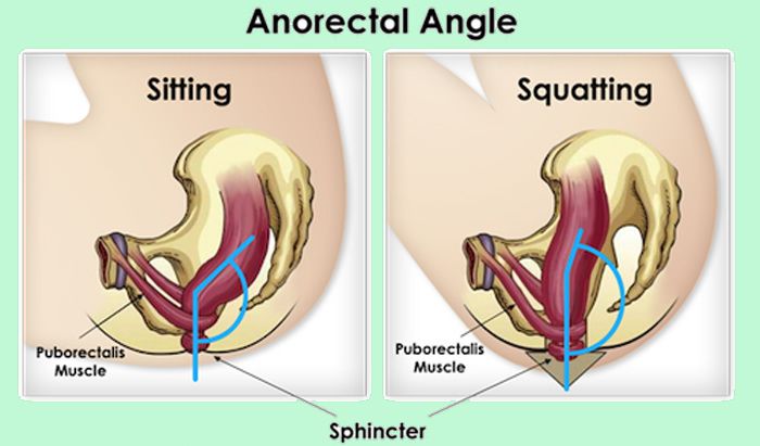 Angulo anorectal