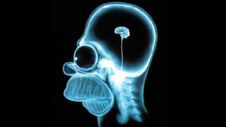 homero cerebro radiografia