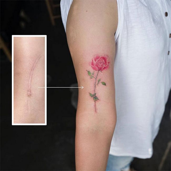 cicatrices convertidas en tatuajes (1)