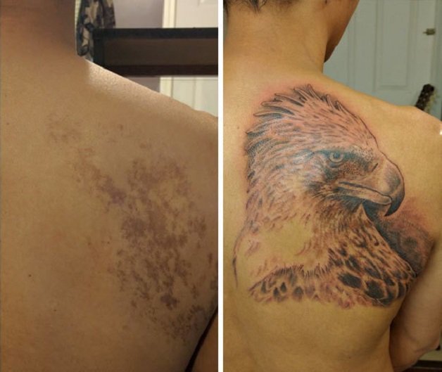 marcas de nacimiento tatuajes (12)