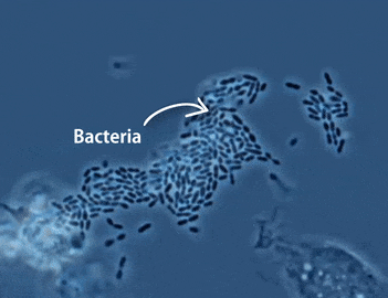 Macrofagos vs bacterias