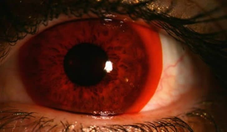 lentes de contacto anaranjados
