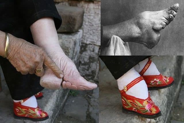 pies de loto en china