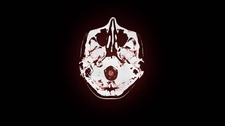 tomografia del cerebro humano