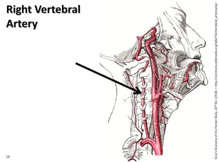 arteria vertebral(1)