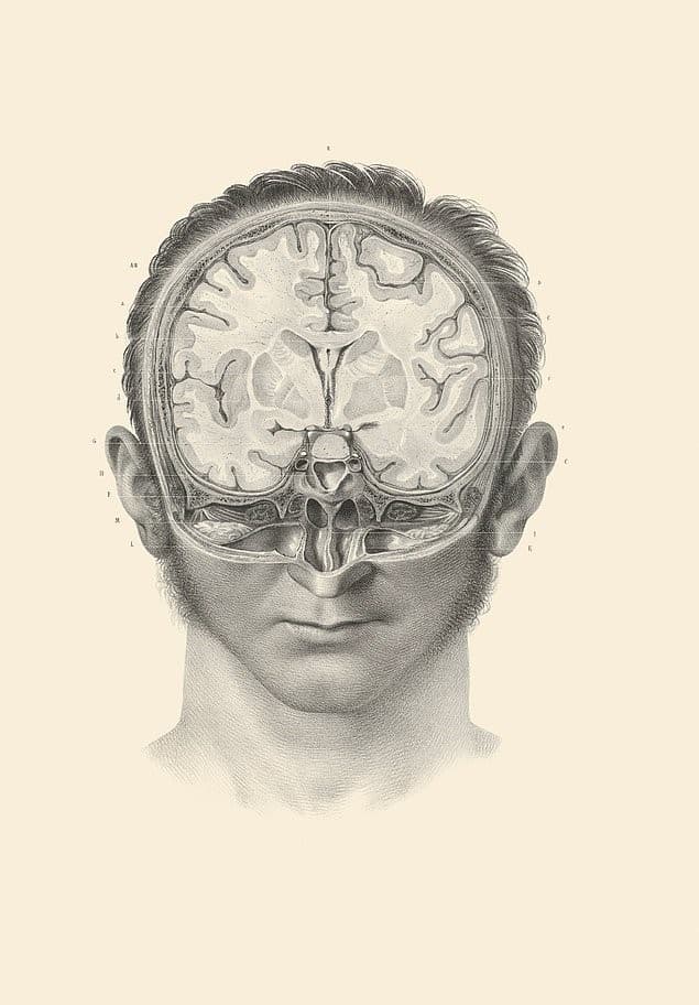 cerebro seccion transversal
