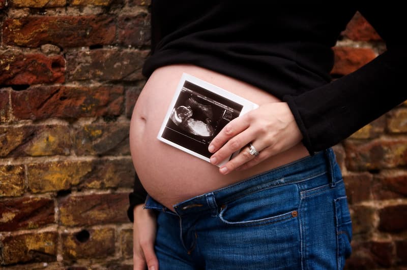ultrasonido embarazo(1)