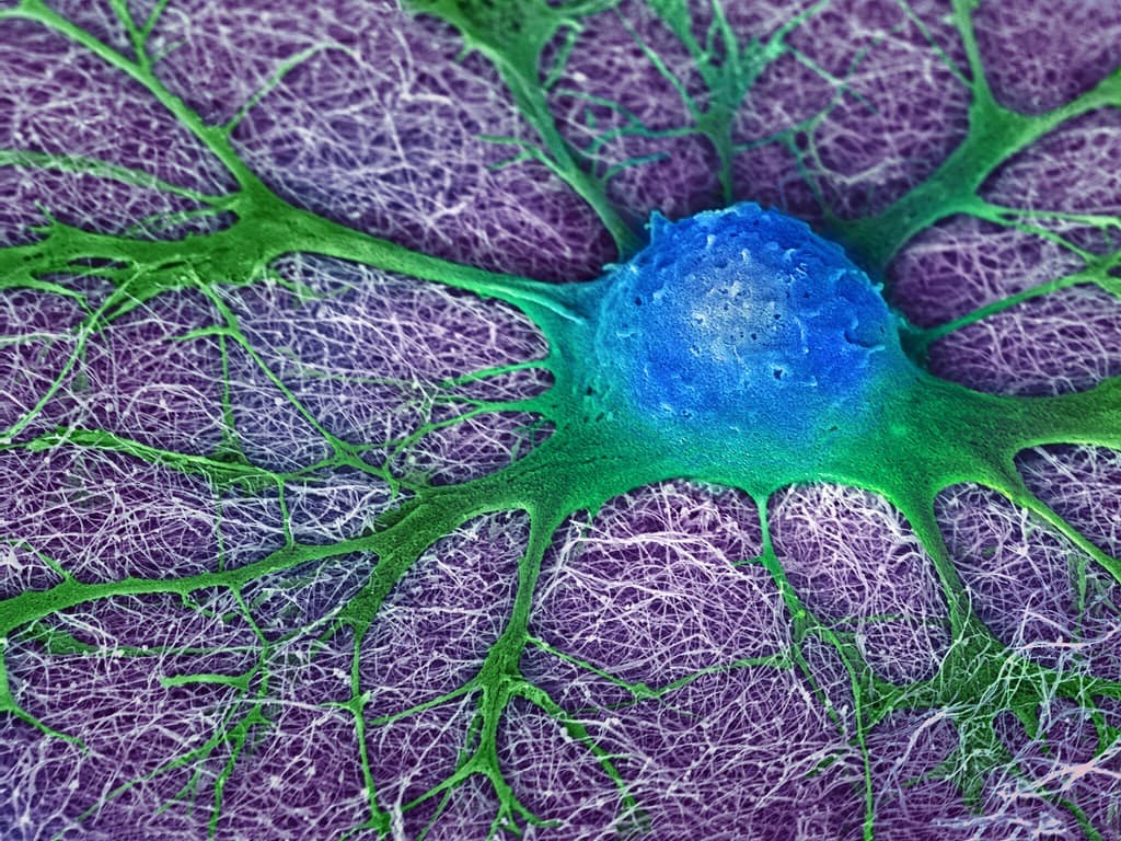 célula madre neural