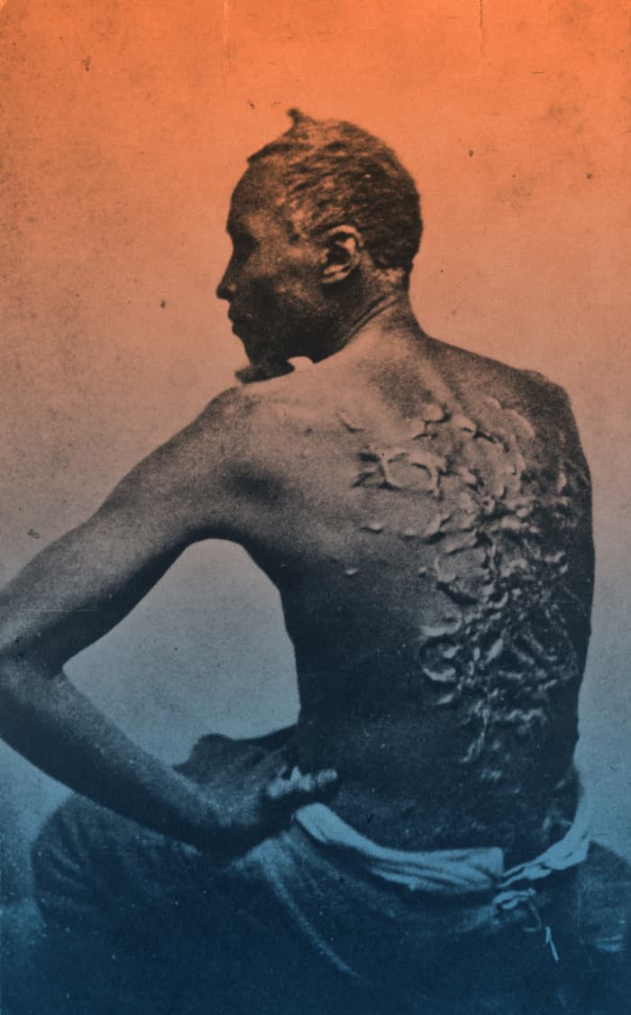 Peter esclavo espalda azotada fotografia Scourged Back