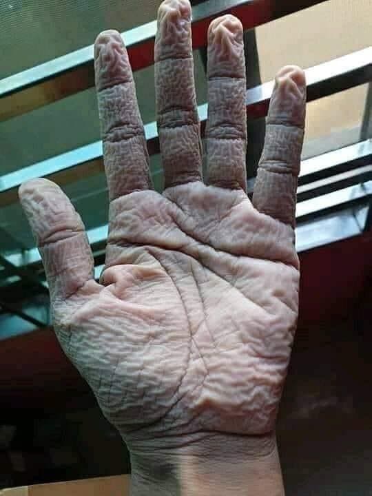 mano de un doctor