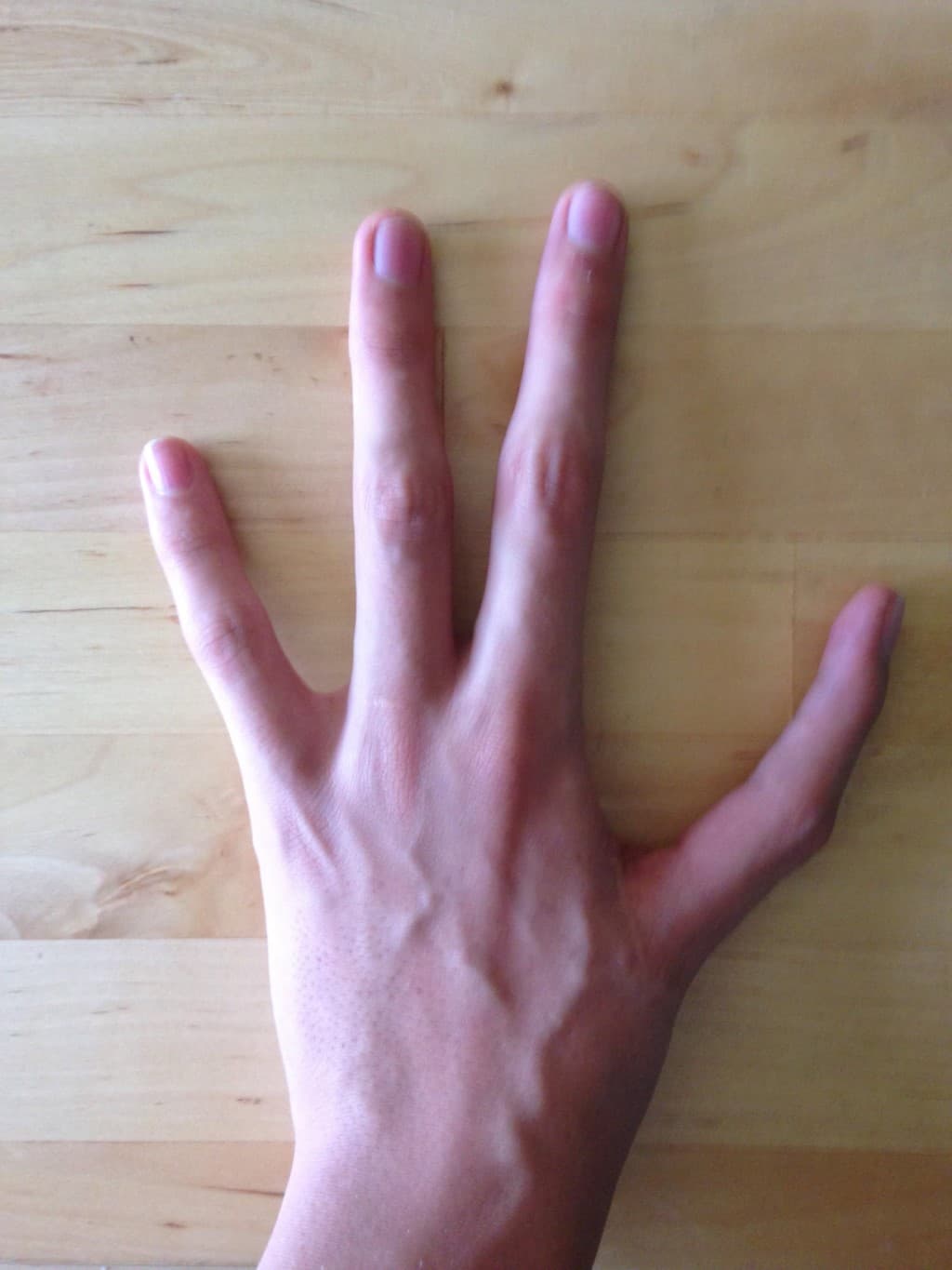 mano con cuatro dedos sin pulgar